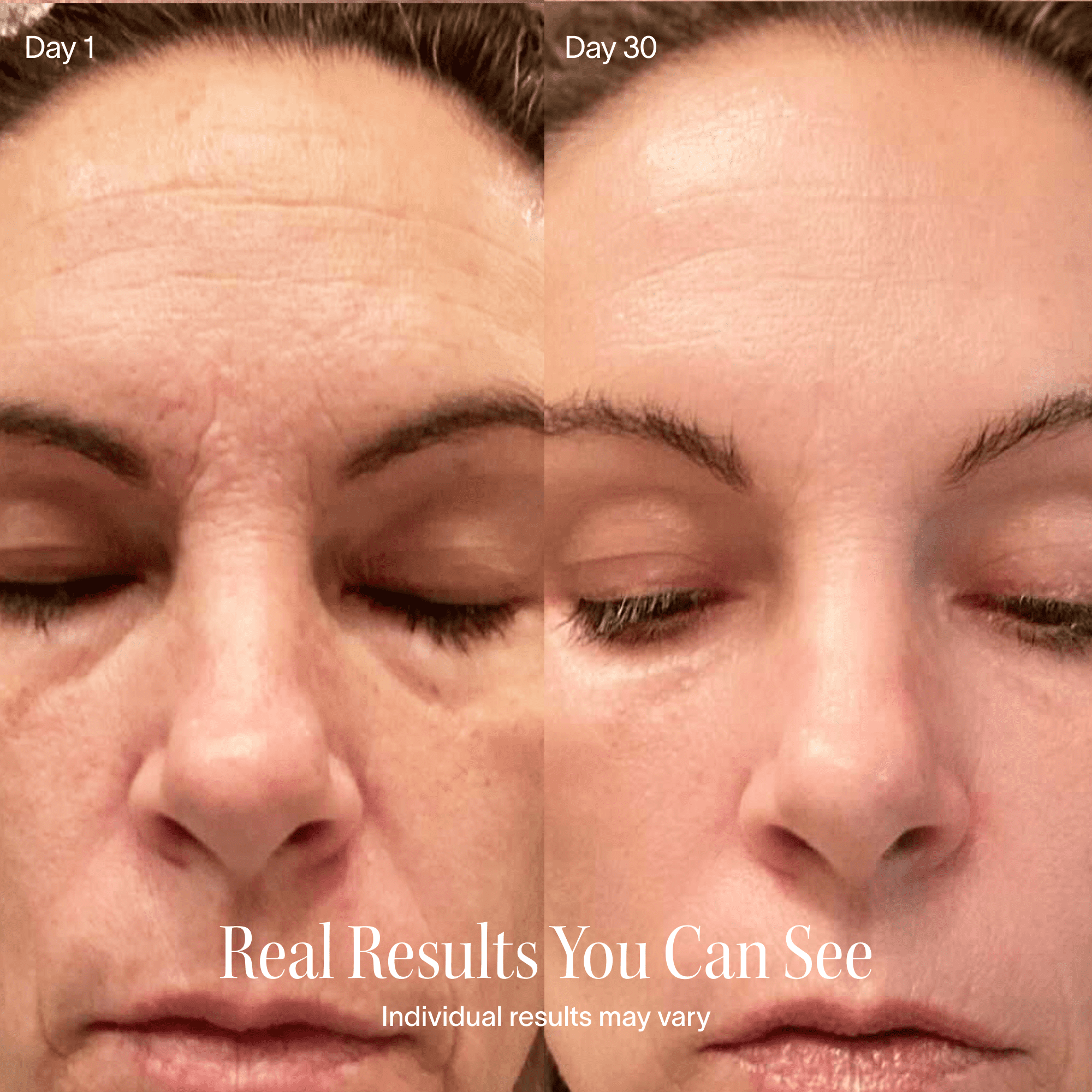 Solawave 4-in-1 Red Light Therapy Skincare Wand - Facial Massage, Galvanic Current, and Warmth - for Face & Neck - FDA Cleared